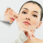 Como elegir un tratamiento facial contra el acne