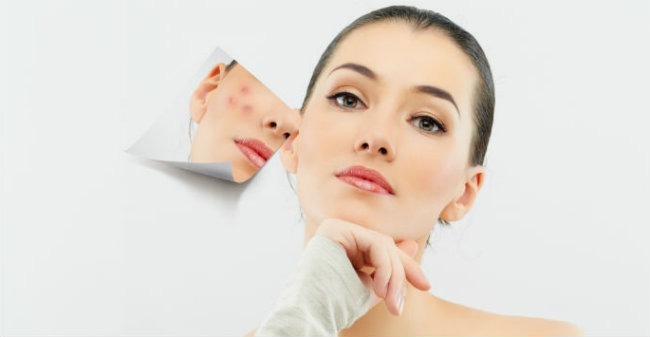Como elegir un tratamiento facial contra el acne